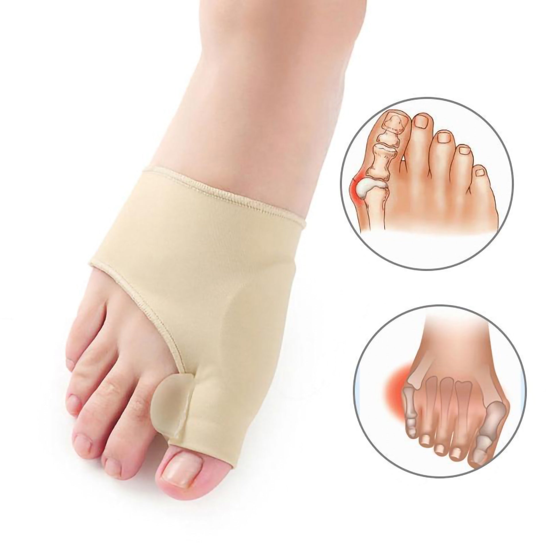 bunion orthopedic corrector