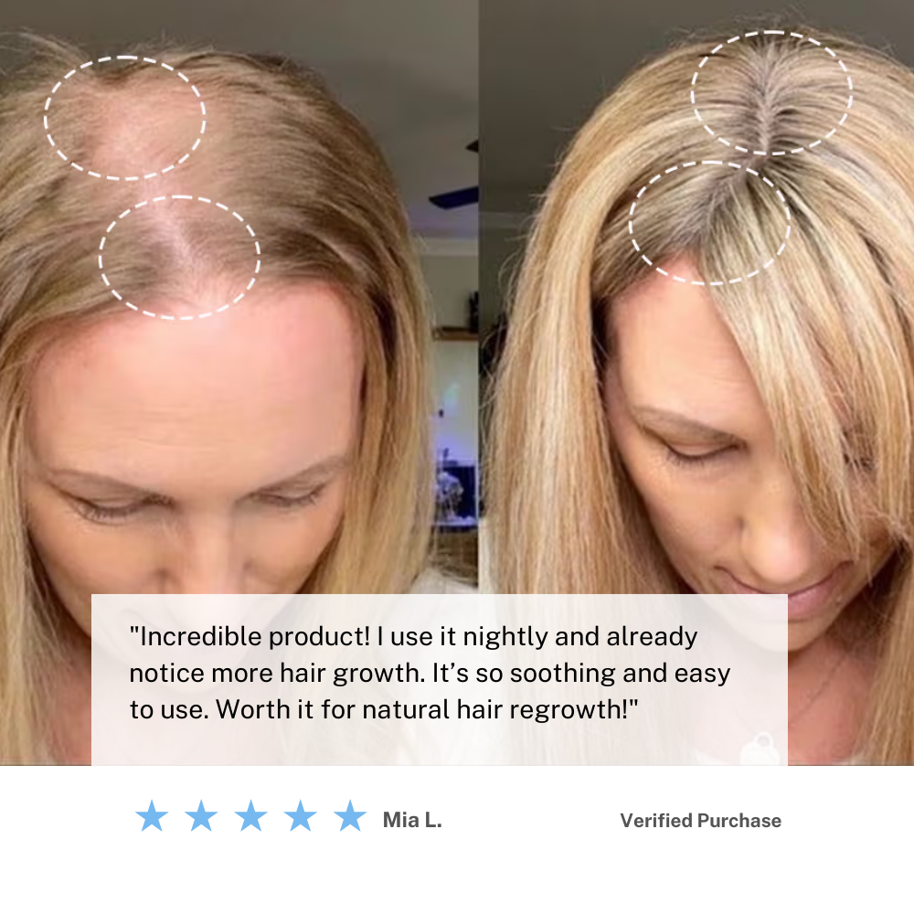 cordless scalp massager for hair growth and relaxation
