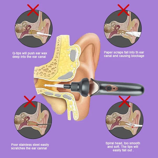 painless ear wax removal kit safe effective family use